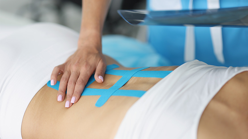 Kinesio Tape